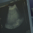 Более 700 будущих мам в Карелии получают единое пособие - ГТРК Карелия