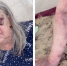 «Они меня кидали и швыряли»: 76-летнюю пенсионерку избили в больнице - Gubdaily.Ru
